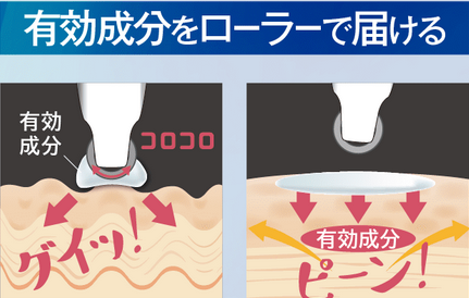 アンテアローラーリッチ